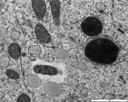Rickettsia-conorii-detected-in-ovaries-from-infected-Rhipicephalus-sanguineus-adult-ticks_W640