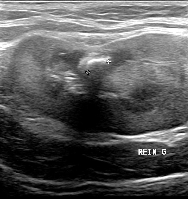 21511120201125_GRIBOUILLE_DUMAS_20201125121629195